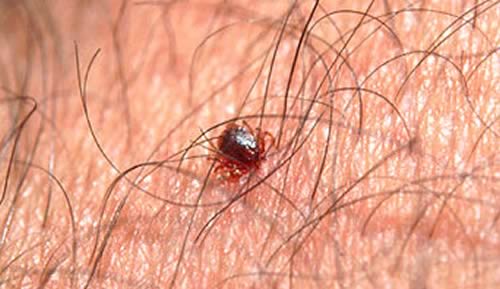 Tick